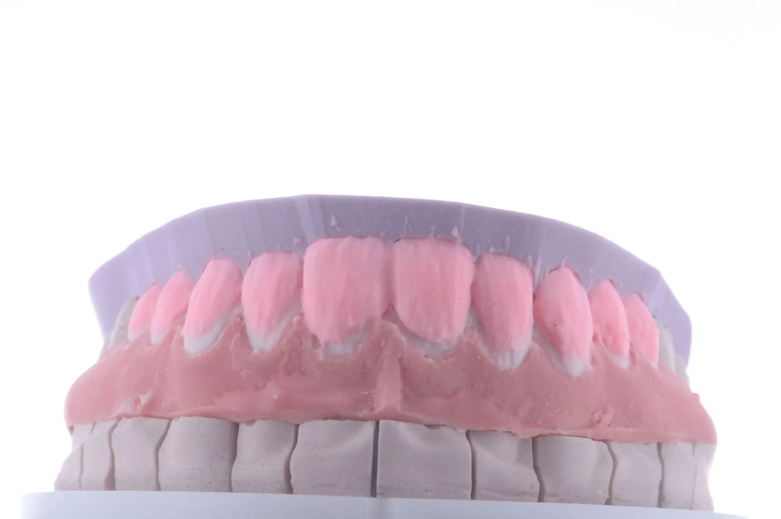 A stone model with a colored diagnostic build-up in the lab